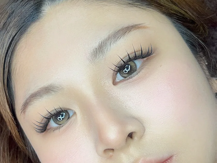 An eye after lash extensions